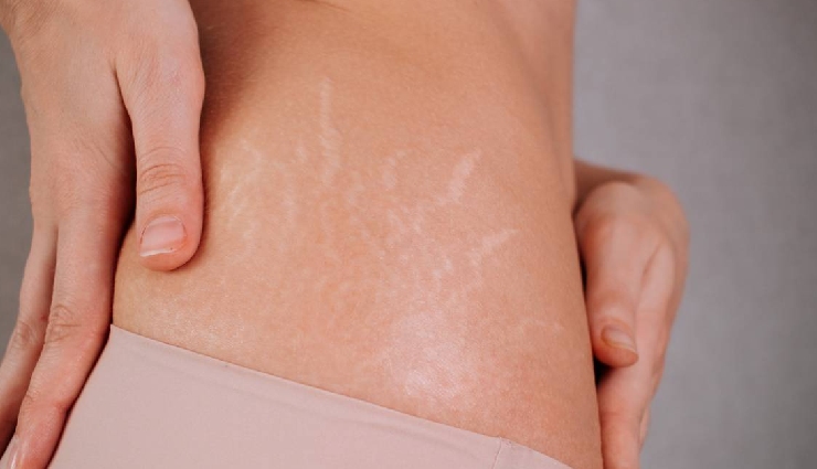 cocoa butter benefits,beauty tips,natural skincare,dark spots remedy,chapped lips treatment,glowing skin,dry skin moisturizer,cocoa butter for hair,uv protection,uneven skin tone remedy