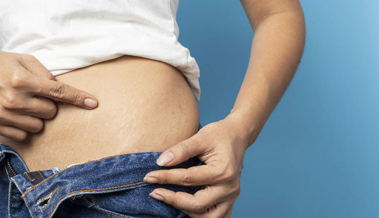 home remedies to get rid of stretch marks,home remedies,stretch marks,skin care tips,beauty tips