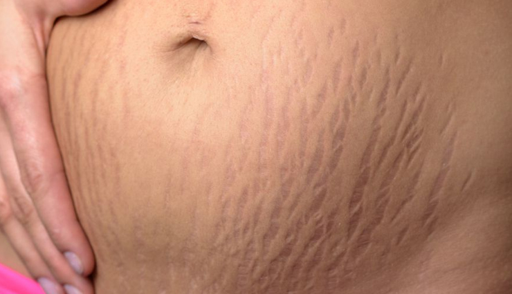 valerian essential oil during pregnancy,valerian oil benefits for pregnant women,least-known benefits of valerian oil during pregnancy,surprising benefits of valerian oil during pregnancy,valerian oil for pregnancy care,valerian oil for pregnancy relief,valerian oil uses during pregnancy,natural benefits of valerian oil during pregnancy,valerian oil for prenatal care,benefits of valerian oil for pregnant women,valerian oil for sleep during pregnancy,valerian oil for anxiety during pregnancy,valerian oil for stress during pregnancy,valerian oil for mood swings during pregnancy,valerian oil for pregnancy insomnia,valerian oil for pregnancy headaches,valerian oil for pregnancy cramps,valerian oil for pregnancy back pain,valerian oil for pregnancy nausea,valerian oil for pregnancy muscle pain