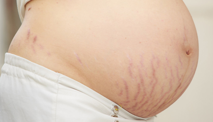 pregnant,benefits of exercise during pregnancy,exercise during pregnancy,exercise in pregnancy,pregnancy tips,Health,Health tips