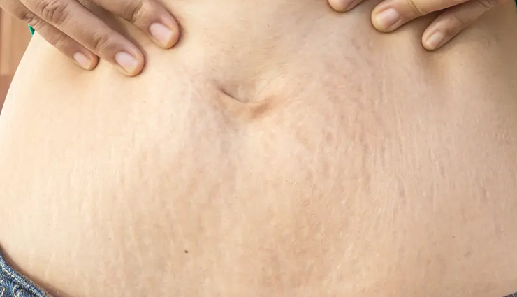 almond oil skincare benefits,benefits of using almond oil for skin,almond oil for radiant skin,nourishing skin with almond oil,almond oil impact on skincare,natural skincare benefits of almond oil,almond oil for healthy and glowing skin,rejuvenating your skin with almond oil,incorporating almond oil into your skincare routine,discover the magic of almond oil for skin