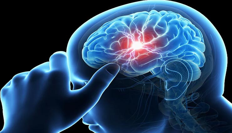 स्ट्रोक के बाद बदल जाती हैं सेक्स लाइफ, यौन इच्छा में आती हैं कमी