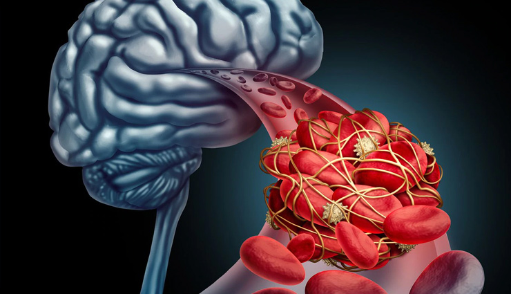 black coffee calories,black coffee in bed,black coffee nutrition,black coffee benefits,black coffee and fasting,black coffee and weight loss,black coffee and diabetes,the black coffee diet,the black coffee shop,black coffee before workout,black coffee brand,black coffee cup,black coffee calories per cup,black coffee during fasting,black coffee disadvantages,black coffee empty stomach,black coffee effects,black coffee everyday,black coffee empty stomach side effects,black coffee for weight loss,black coffee fasting blood test,black coffee for asthma,black coffee good for you,black coffee good for weight loss,black coffee good for liver,black coffee health benefits,black coffee in the morning,i drink black coffee,calories i black coffee,black coffee kidney stones,black coffee lose weight,black coffee liver,black coffee meaning,black coffee no sugar no cream,black coffee nutrition facts,calories in black coffee,black and bold coffee.
black coffee ok for fasting