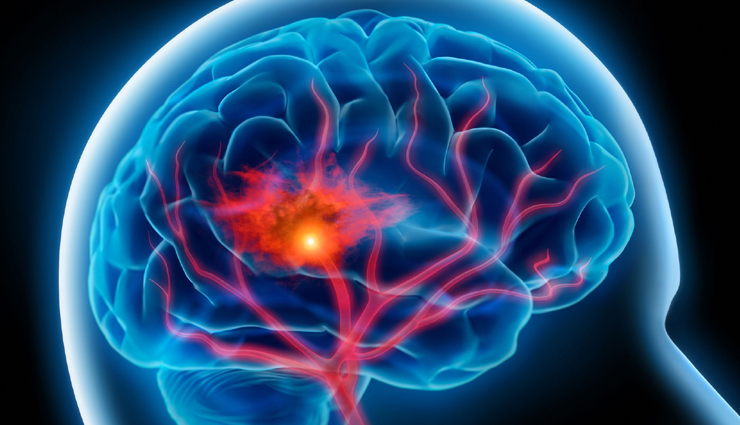 neurological signs,nerve damage indicators,cognitive warning signs,brain function decline,weak nerve signals,neural impairment symptoms,mental weakness indicators,nervous system alerts,brain-related frailty signs,neurological vulnerability signals,cognitive nerve warnings,brain weakness manifestations,neural dysfunction clues,cognitive decline indications,nerve-related debilitation signs,मानसिक कमजोरी,न्यूरोलॉजिकल लक्षण,बुद्धिमत्ता की गिरावट,तंत्रिका प्रणाली संकेत,मस्तिष्क संबंधित कमजोरी,संवेदनशीलता के लक्षण,तंत्रिका निर्विकारण संकेत,मस्तिष्क स्वास्थ्य बिगड़ने के इशारे,स्नायु-संबंधी कमजोरी के लक्षण