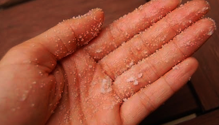 stretch marks,natural ways to get rid of stretch marks,stretch marks beauty treatment,stretch marks beauty hacks,beauty,skin care,skin care tips,beauty tips