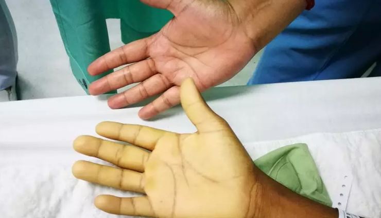 sugarcane juice,health benefits of sugarcane juice,Health tips,fitness tips