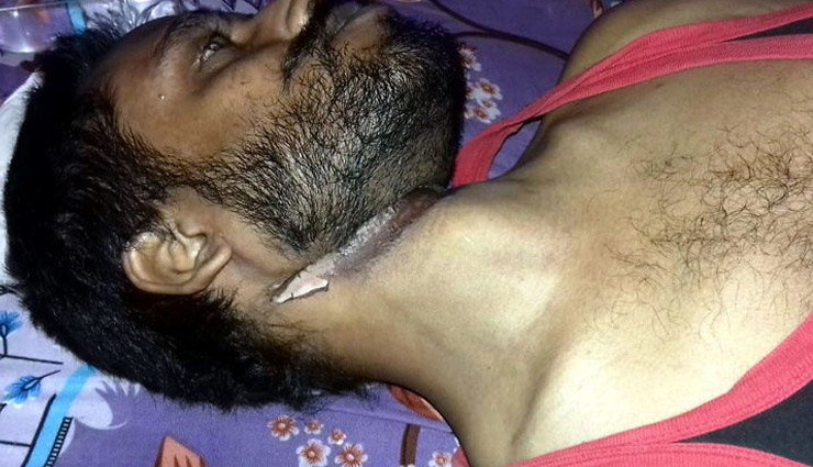 नाराज पत्नी नहीं मानी तो युवक ने पंखे से फंदा लगाकर की सुसाइड
