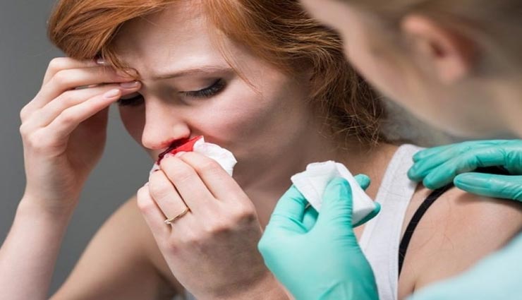 Health tips,health tips in hindi,home remedies,nakseer home remedies,nose bleeding remedies