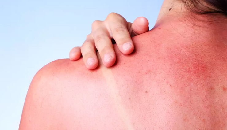 dates,beauty benefits of skin,dates benefits for skin,dates beauty benefits,beauty,skin care tips,beauty tips