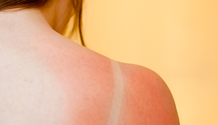 apple cider vinegar,beauty benefits of apple cider vinegar,apple cider vinegar for skin beauty,apple cider vinegar for skin care,apple cider vinegar for skin care tips,skin,skin care,skin beauty,healthy skin