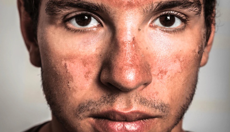 mens skincare tips,skin damage men,sun damage skin,smoke effects on skin,premature aging men,mens skin protection,facial skin care men,skincare awareness men,skin aging causes,how to protect skin men