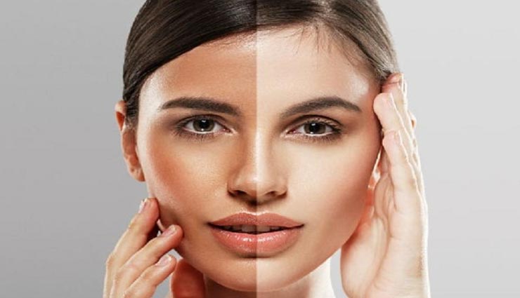 इस एक नुस्खें से रातोंरात दूर होगी टैनिंग की समस्या, चेहरे पर आएगी रौनक