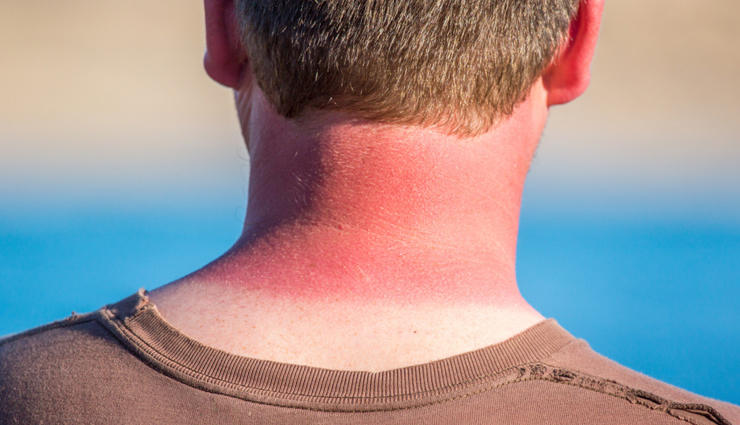 healthy living,5 diseases of summer,summer diseases,diseases that would hurt in summers,summers