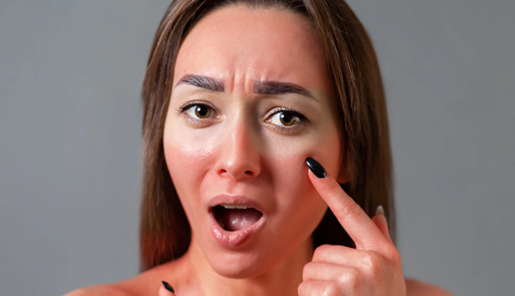 monsoon skin problems,skin issues during rainy season,common skin problems in monsoon,home remedies for monsoon skin problems,natural remedies for rainy season skin issues,getting rid of skin problems in the monsoon,monsoon skincare tips,treating skin problems during rainy season,monsoon skincare home remedies,healthy skin in the monsoon