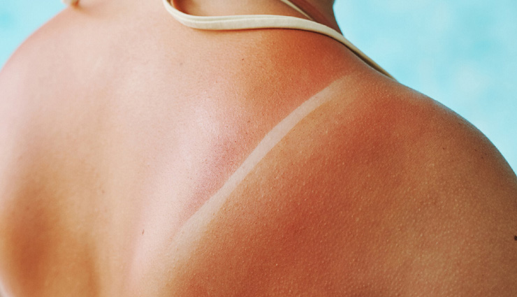 skin pcommon skin problems home remedies,home remedies for skin issues,most common skin problems,natural solutions for skin problems,home remedies for acne,home remedies for eczema,treating skin problems at home,diy skin treatments,natural skin care tips,common skin conditions home remediesroblems