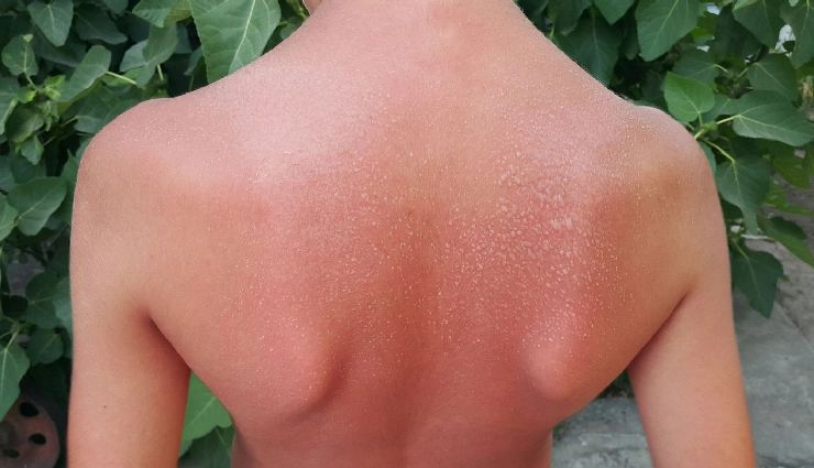 benefits of tomatoes for skin,tomatoes for body care,natural skincare remedies,antioxidant-rich foods,tomatoes for glowing skin,home remedies with tomato,tomato face pack,skincare with tomatoes,vitamin c for skin,natural beauty tips