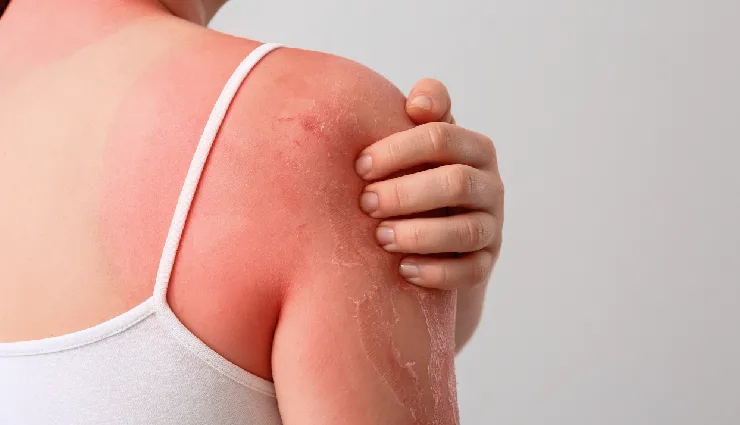 aloe vera benefits for skin,aloe vera for acne,aloe vera for glowing skin,natural skincare remedies,aloe vera gel uses,hydrating aloe vera,aloe vera for sunburn,aloe vera healing properties,skincare with aloe vera,aloe vera home remedies,anti-inflammatory aloe vera,aloe vera moisturizer,aloe vera for irritation,plant of immortality skin benefits,natural skin healing