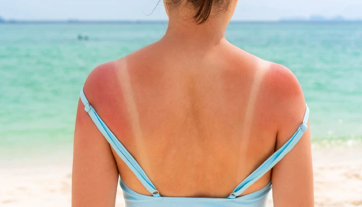 aloe vera benefits,aloe vera for skin,aloe vera for hair,aloe vera gel uses,aloe vera for acne,aloe vera for sunburn,aloe vera home remedies,natural skincare with aloe vera,aloe vera for dry skin,aloe vera for glowing skin,aloe vera for dandruff,aloe vera for hair growth