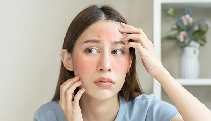 apple cider vinegar for skin,acv skincare benefits,diy apple cider vinegar remedies,apple cider vinegar for acne,apple cider vinegar toner,natural skincare with acv,apple cider vinegar for glowing skin,apple cider vinegar for oily skin,apple cider vinegar for irritation,apple cider vinegar skin care routine