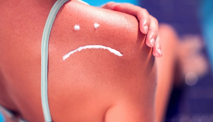 home remedies to treat sunburn,sunburn skin care tips,beauty tips