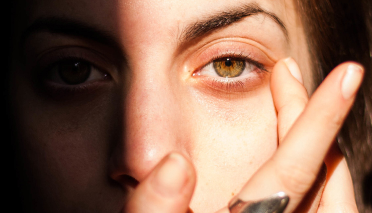 5 Quick Home Remedies To Treat Sunburn Eyes