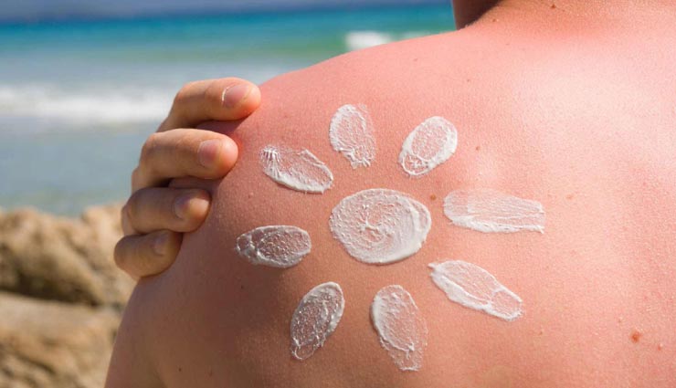 ये नेचुरल उपाय दिलाएंगे सनबर्न से छुटकारा, जानें और आजमाए