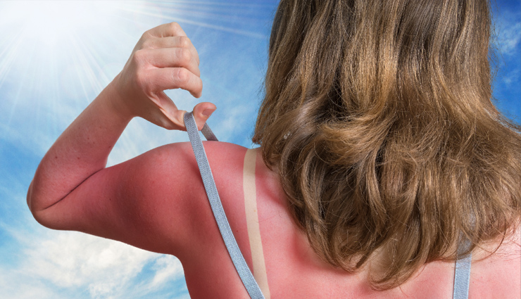 tomato for skin,tomato benefits for skin,skin brightening with tomato,tomato acne treatment,hydrating tomato face pack,anti-aging tomato skincare,tightening pores with tomato,sunburn relief with tomato,natural exfoliation with tomato,tomato diy face packs