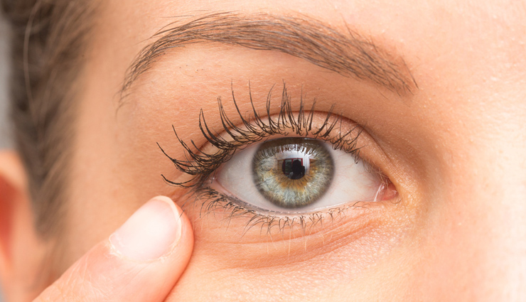 5 Home Remedies To Get Rid of Sunken Eyes