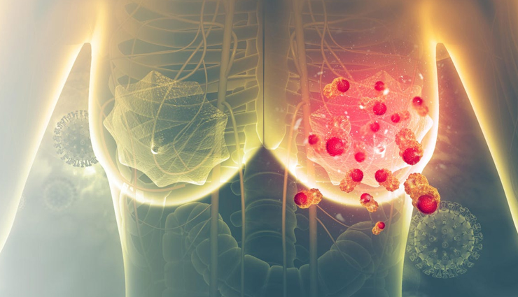 Sunscreen,side effects of sunscreen,sunscreen for skin,beauty tips,skin care tips