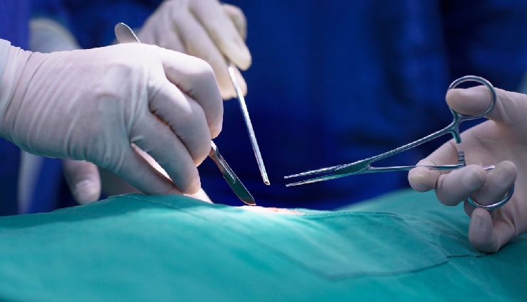 early menopause,signs of early menopause,causes of missed periods,female reproductive health,hormonal changes in women,pms symptoms,menopause before 40,menstrual cycle issues,early menopause effects,fertility and menopause,women’s health awareness,period stopped early