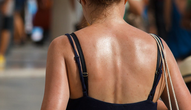 causes of rash on the back,back rash explanations,understanding back rash triggers,what causing my back rash?,back rash symptoms and causes,common reasons for back rash,identifying the rash on your back,treating rashes on the back,back rash diagnosis and treatment,managing back rash discomfort