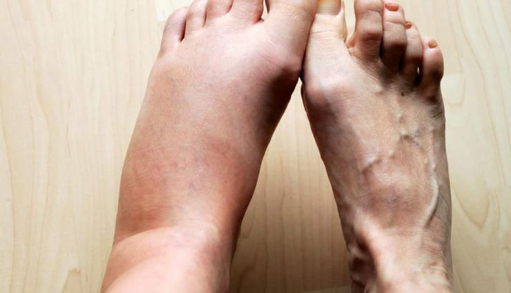 feet,feet disease,feet symptoms,Health tips,health tips in hindi