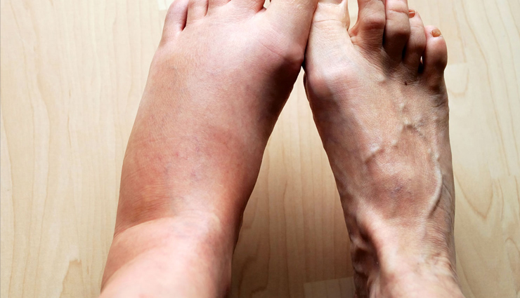 dandelion root,eating dandelion root,health benefits of eating dandelion root,blood pressure,skin health,urinary problem,diabetes,weight loss,liver health,cancer,anti cancer properties,digestive system,smooth digestive system,health updates,Health tips