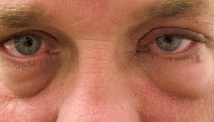 skin benefits of drinking water,amazing effects of water on skin,hydration and skin health advantages,drinking water for radiant skin,water impact on skin complexion,benefits of hydration for skin care,how water improves skin texture,skin hydration benefits of drinking water,clear skin benefits from water intake,hydrate for glowing and healthy skin