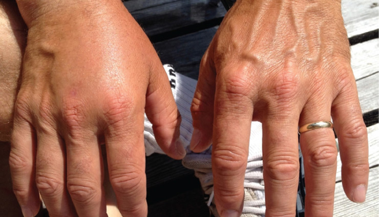 phalsa,phalsa benefits,falsa benefits,falsa benefits in hindi,phalsa benefits in hindi,healthy food,Health tips