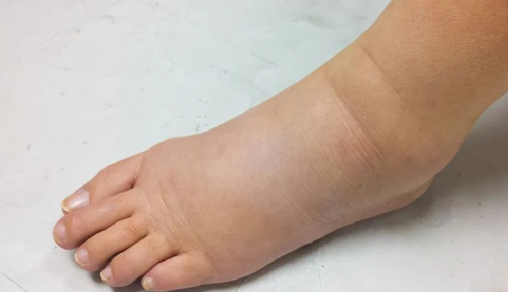 improve cardiovascular health,heart health tips,cardiovascular wellness,boost heart function,heart disease prevention,healthy heart lifestyle,enhance heart health