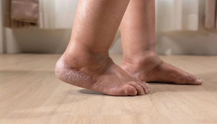 heart health warning signs,early signs of heart problems,symptoms of heart disease,heart health tips,poor heart function signs,heart attack warning signs,heart health awareness,how to detect heart problems early,heart disease symptoms in men and women