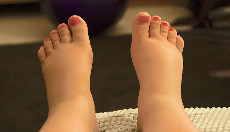 heart diseases that appear on your skin,heart diseases,healthy living,Health tips