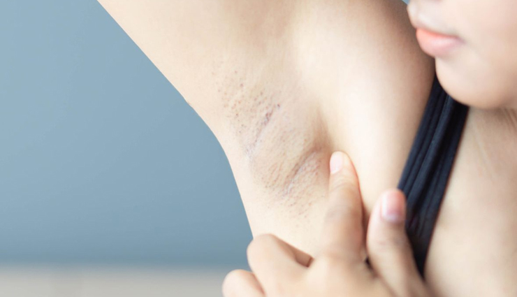 monkeypox symptoms,monkeypox rash,monkeypox fever,monkeypox headache,monkeypox muscle aches,monkeypox swollen lymph nodes,monkeypox skin lesions,monkeypox transmission,monkeypox prevention,monkeypox outbreak,monkeypox zoonotic virus,monkeypox vaccination,monkeypox public health,monkeypox infection control,monkeypox orthopoxvirus