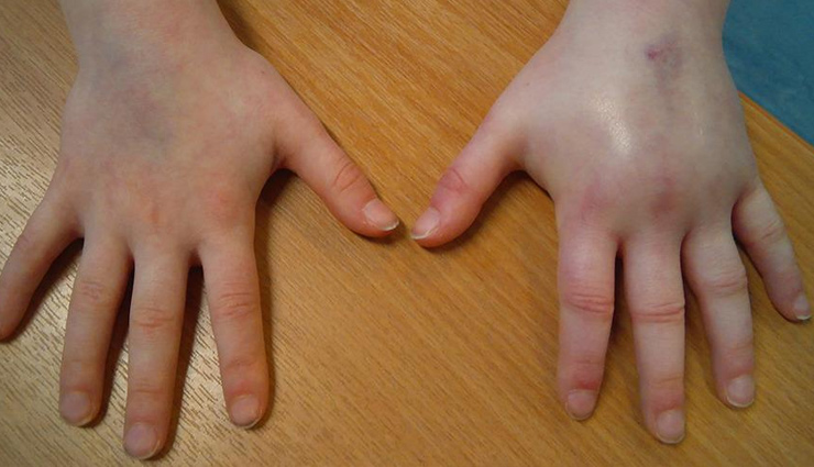 health warnings hands,signs of health issues hands,nail color health warning,swollen fingers health sign,tingling hands causes,dry skin health warning,hand shape deformities,health clues from hands,hands reveal health problems,health conditions visible in hands