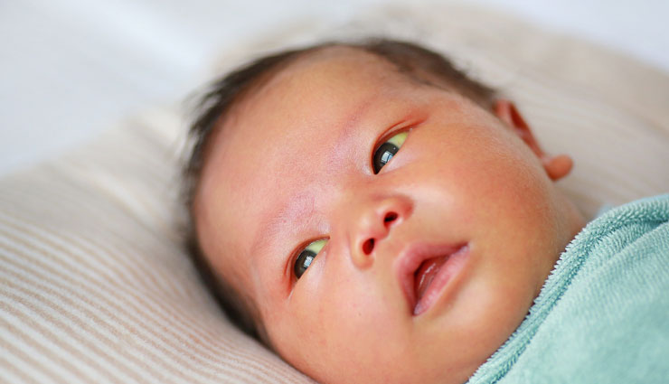 5 Symptoms of Jaundice You Must Be Aware About
