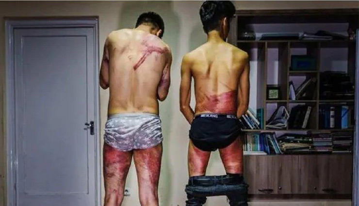 बर्बरता की तस्वीर! पाकिस्तान विरोधी प्रदर्शन कवर करने पर दो पत्रकारों को तालिबान लड़ाकों ने बेरहमी से पीटा