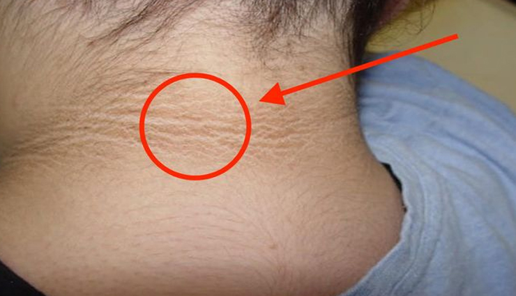 tamarind,beauty benefits of tamarind,skin care tips,beauty tips