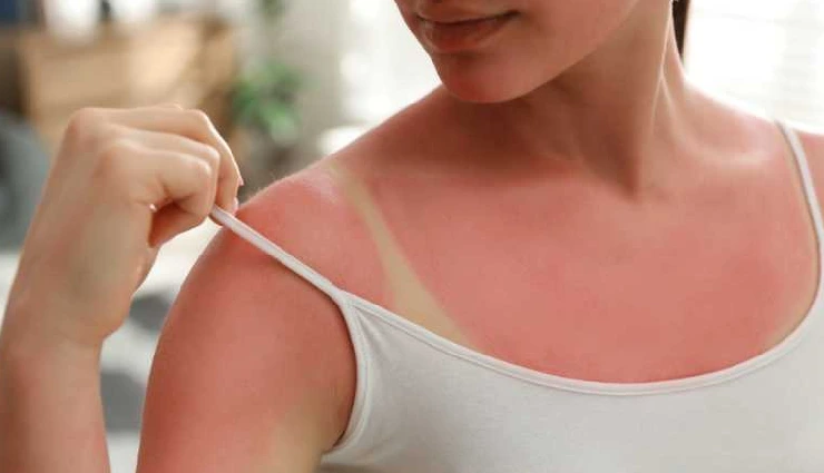 turmeric benefits for skin,turmeric face pack,turmeric for glowing skin,turmeric for acne,turmeric for pigmentation,turmeric face mask diy,turmeric skincare remedies,natural skin brightening,turmeric beauty tips,turmeric anti-ageing benefits