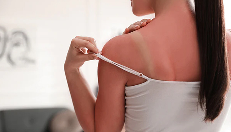 Simple Tips To Remove Tan From The Hands