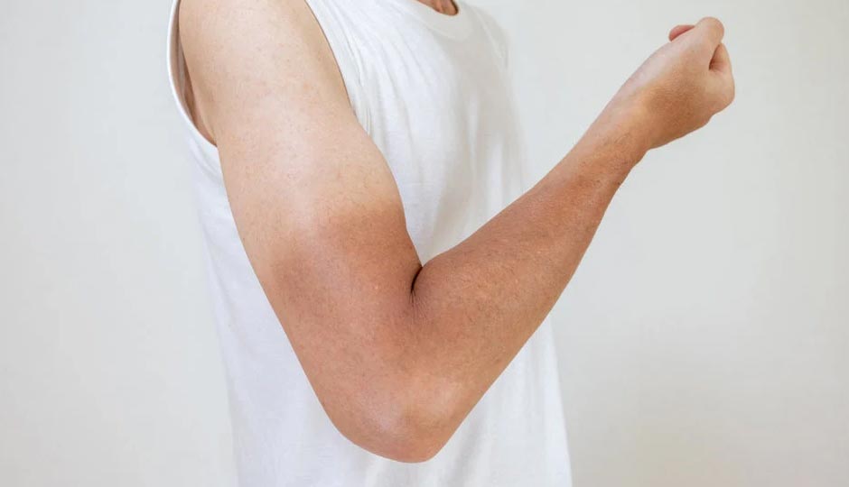 7 Home Remedies To Treat Tan on Hands