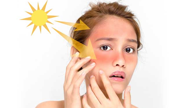 5 Homemade Face Packs To Get Rid Of Tan