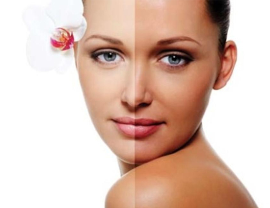 5 Natural Ways to Get Rid of Forehead Tan