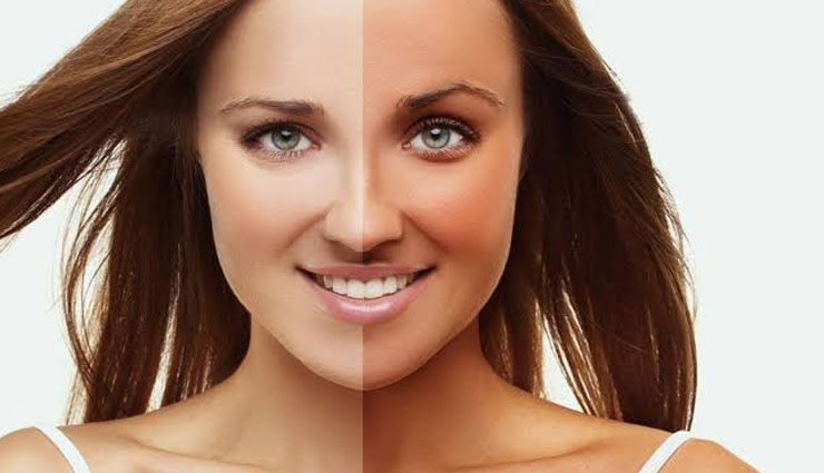 home remedies,home remedies for sun tanned skin,tanned skin tips,skin care tips,beauty tips