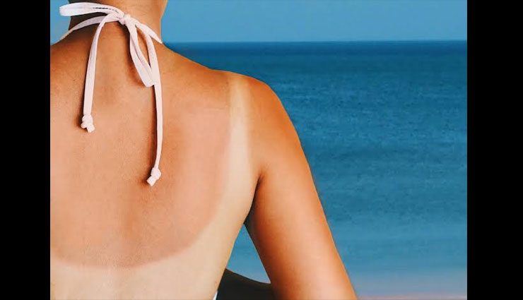 home remedies,home remedies for sun tanned skin,tanned skin tips,skin care tips,beauty tips